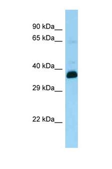 SNUPN Antibody - SNUPN antibody Western blot of Rat Brain lysate. Antibody concentration 1 ug/ml.  This image was taken for the unconjugated form of this product. Other forms have not been tested.
