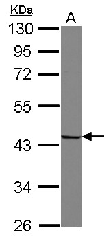 SNUPN Antibody - Sample (30 ug of whole cell lysate) A: U87-MG 10% SDS PAGE SNUPN antibody diluted at 1:1000