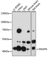 SNUPN Antibody - Western blot analysis of extracts of various cell lines, using SNUPN antibody at 1:3000 dilution. The secondary antibody used was an HRP Goat Anti-Rabbit IgG (H+L) at 1:10000 dilution. Lysates were loaded 25ug per lane and 3% nonfat dry milk in TBST was used for blocking. An ECL Kit was used for detection and the exposure time was 90s.