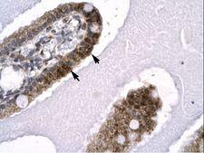 SNW1 / SKIP Antibody - SNW1 / SKIP antibody ARP32294_P050-NP_036377-SKIIP Antibody was used in IHC to stain formalin-fixed, paraffin-embedded human intestine.  This image was taken for the unconjugated form of this product. Other forms have not been tested.