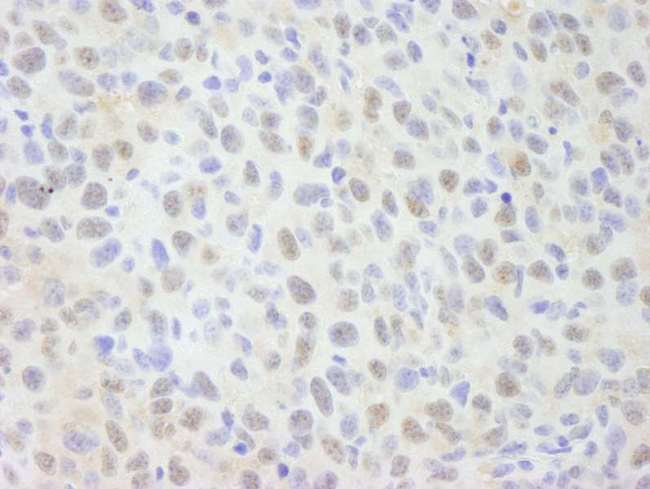 SNW1 / SKIP Antibody - Detection of Mouse NCOA62 by Immunohistochemistry. Sample: FFPE section of mouse squamous cell carcinoma. Antibody: Affinity purified rabbit anti-NCOA62 used at a dilution of 1:250.