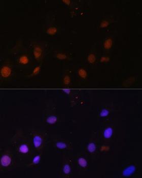 SNW1 / SKIP Antibody - Immunofluorescence analysis of U-2OS cells using SNW1 Polyclonal Antibody at dilution of 1:100.Blue: DAPI for nuclear staining.