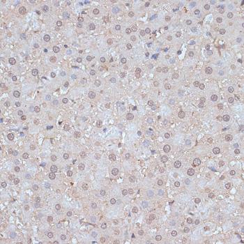 SNW1 / SKIP Antibody - Immunohistochemistry of paraffin-embedded Rat liver using SNW1 Polyclonal Antibody at dilution of 1:100 (40x lens).