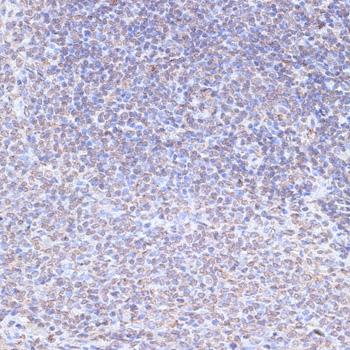 SNW1 / SKIP Antibody - Immunohistochemistry of paraffin-embedded Rat spleen using SNW1 Polyclonal Antibody at dilution of 1:100 (40x lens).