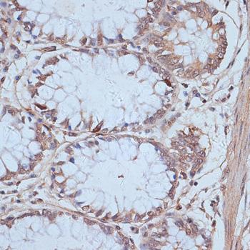 SNW1 / SKIP Antibody - Immunohistochemistry of paraffin-embedded Human colon using SNW1 Polyclonal Antibody at dilution of 1:100 (40x lens).