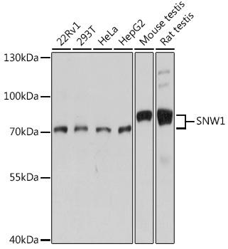 SNW1 / SKIP Antibody - Western blot analysis of extracts of various cell lines using SNW1 Polyclonal Antibody at dilution of 1:1000.