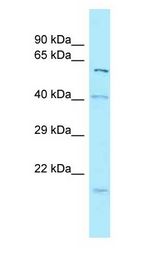 SNX1 Antibody - SNX1 antibody Western Blot of 721_B.  This image was taken for the unconjugated form of this product. Other forms have not been tested.