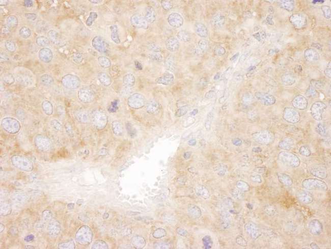 SNX1 Antibody - Detection of Mouse SNX1 by Immunohistochemistry. Sample: FFPE section of mouse renal cell carcinoma. Antibody: Affinity purified rabbit anti-SNX1 used at a dilution of 1:250.