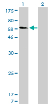 SNX1 Antibody - Western blot of SNX1 expression in transfected 293T cell line by SNX1 monoclonal antibody (M01), clone 6H1.