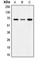SNX1 Antibody - Western blot analysis of SNX1 expression in MCF7 (A); SP2/0 (B); H9C2 (C) whole cell lysates.