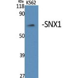 SNX1 Antibody - Western blot of SNX1 antibody