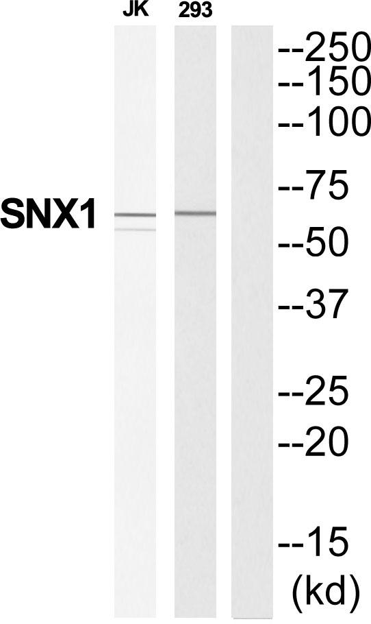 SNX1 Antibody - Western blot analysis of extracts from Jurkat/293 cells, using SNX1 antibody.