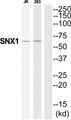 SNX1 Antibody - Western blot analysis of extracts from Jurkat/293 cells, using SNX1 antibody.