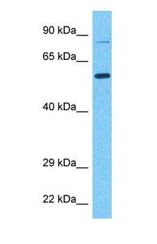 SNX1 Antibody - Western blot of SNX1 Antibody with human Fetal Lung lysate.  This image was taken for the unconjugated form of this product. Other forms have not been tested.