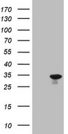 SNX10 Antibody - HEK293T cells were transfected with the pCMV6-ENTRY control. (Left lane) or pCMV6-ENTRY SNX10. (Right lane) cDNA for 48 hrs and lysed. Equivalent amounts of cell lysates. (5 ug per lane) were separated by SDS-PAGE and immunoblotted with anti-SNX10. (1:2000)
