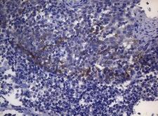 SNX10 Antibody - Immunohistochemical staining of paraffin-embedded Human bladder tissue within the normal limits using anti-SNX10 mouse monoclonal antibody. (Heat-induced epitope retrieval by 1mM EDTA in 10mM Tris buffer. (pH8.5) at 120°C for 3 min. (1:150)