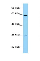SNX11 Antibody - SNX11 antibody Western blot of HeLa Cell lysate. Antibody concentration 1 ug/ml.  This image was taken for the unconjugated form of this product. Other forms have not been tested.