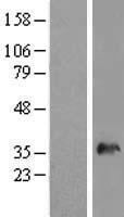 SNX11 Protein - Western validation with an anti-DDK antibody * L: Control HEK293 lysate R: Over-expression lysate