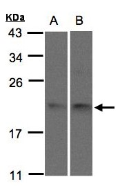 SNX12 Antibody - Sample (30 ug of whole cell lysate). A:293T, B: H1299. 15% SDS PAGE. SNX12 antibody diluted at 1:1500
