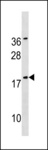 SNX12 Antibody - SNX12 Antibody western blot of A2058 cell line lysates (35 ug/lane). The SNX12 antibody detected the SNX12 protein (arrow).