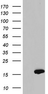SNX12 Antibody - HEK293T cells were transfected with the pCMV6-ENTRY control (Left lane) or pCMV6-ENTRY SNX12 (Right lane) cDNA for 48 hrs and lysed. Equivalent amounts of cell lysates (5 ug per lane) were separated by SDS-PAGE and immunoblotted with anti-SNX12.