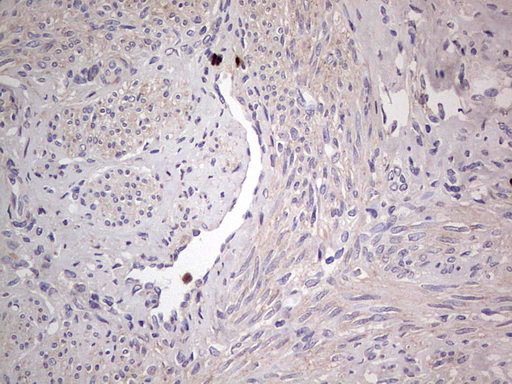 SNX12 Antibody - Immunohistochemical staining of paraffin-embedded Human endometrium tissue within the normal limits using anti-SNX12 mouse monoclonal antibody. (Heat-induced epitope retrieval by 1 mM EDTA in 10mM Tris, pH8.5, 120C for 3min,