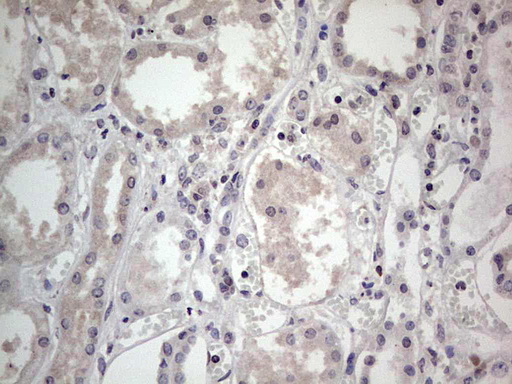 SNX12 Antibody - Immunohistochemical staining of paraffin-embedded Human Kidney tissue within the normal limits using anti-SNX12 mouse monoclonal antibody. (Heat-induced epitope retrieval by 1 mM EDTA in 10mM Tris, pH8.5, 120C for 3min,