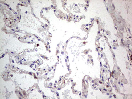 SNX12 Antibody - Immunohistochemical staining of paraffin-embedded Human lung tissue within the normal limits using anti-SNX12 mouse monoclonal antibody. (Heat-induced epitope retrieval by 1 mM EDTA in 10mM Tris, pH8.5, 120C for 3min,