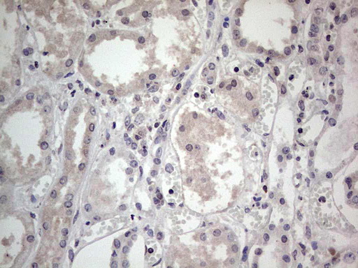 SNX12 Antibody - IHC of paraffin-embedded Human Kidney tissue using anti-SNX12 mouse monoclonal antibody. (Heat-induced epitope retrieval by 1 mM EDTA in 10mM Tris, pH8.5, 120°C for 3min).