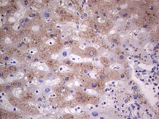 SNX12 Antibody - IHC of paraffin-embedded Human liver tissue using anti-SNX12 mouse monoclonal antibody. (Heat-induced epitope retrieval by 1 mM EDTA in 10mM Tris, pH8.5, 120°C for 3min).