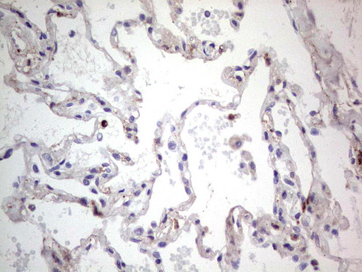 SNX12 Antibody - IHC of paraffin-embedded Human lung tissue using anti-SNX12 mouse monoclonal antibody. (Heat-induced epitope retrieval by 1 mM EDTA in 10mM Tris, pH8.5, 120°C for 3min).