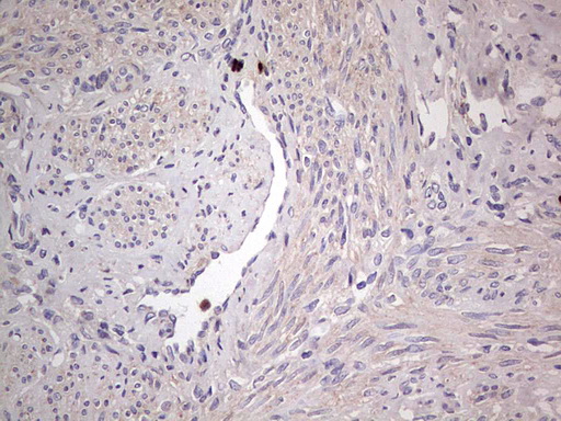 SNX12 Antibody - IHC of paraffin-embedded Human endometrium tissue using anti-SNX12 mouse monoclonal antibody. (Heat-induced epitope retrieval by 1 mM EDTA in 10mM Tris, pH8.5, 120°C for 3min).