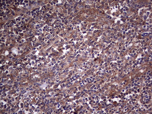 SNX12 Antibody - Immunohistochemical staining of paraffin-embedded Human tonsil within the normal limits using anti-SNX12 mouse monoclonal antibody. (Heat-induced epitope retrieval by 1 mM EDTA in 10mM Tris, pH8.5, 120C for 3min,