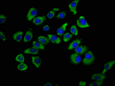 SNX12 Antibody - Immunofluorescence staining of A549 cells at a dilution of 1:200, counter-stained with DAPI. The cells were fixed in 4% formaldehyde, permeabilized using 0.2% Triton X-100 and blocked in 10% normal Goat Serum. The cells were then incubated with the antibody overnight at 4 °C.The secondary antibody was Alexa Fluor 488-congugated AffiniPure Goat Anti-Rabbit IgG (H+L) .