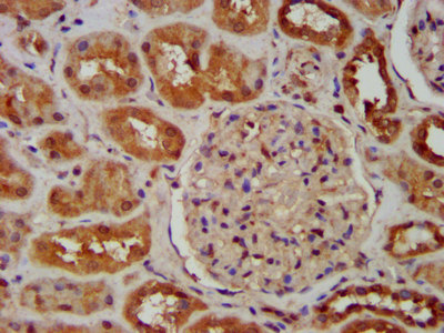 SNX12 Antibody - Immunohistochemistry image at a dilution of 1:600 and staining in paraffin-embedded human kidney tissue performed on a Leica BondTM system. After dewaxing and hydration, antigen retrieval was mediated by high pressure in a citrate buffer (pH 6.0) . Section was blocked with 10% normal goat serum 30min at RT. Then primary antibody (1% BSA) was incubated at 4 °C overnight. The primary is detected by a biotinylated secondary antibody and visualized using an HRP conjugated SP system.