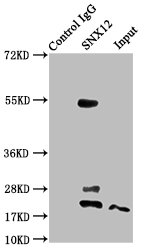 SNX12 Antibody - Immunoprecipitating SNX12 in A549 whole cell lysate Lane 1: Rabbit control IgG instead of SNX12 Antibody in A549 whole cell lysate.For western blotting, a HRP-conjugated Protein G antibody was used as the secondary antibody (1/2000) Lane 2: SNX12 Antibody (6µg) + A549 whole cell lysate (500µg) Lane 3: A549 whole cell lysate (20µg)