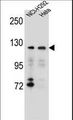 SNX13 Antibody - SNX13 Antibody western blot of NCI-H292,HeLa cell line lysates (35 ug/lane). The SNX13 antibody detected the SNX13 protein (arrow).