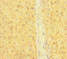 SNX14 Antibody - Immunohistochemistry of paraffin-embedded human adrenal gland tissue at dilution of 1:100