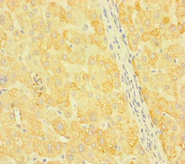 SNX14 Antibody - Immunohistochemistry of paraffin-embedded human liver tissue at dilution of 1:100