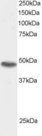 SNX15 Antibody - Antibody staining (0.5 ug/ml) of 293 lysate (RIPA buffer, 30 ug total protein per lane). Primary incubated for 1 hour. Detected by Western blot of chemiluminescence.