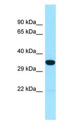 SNX15 Antibody - SNX15 antibody Western Blot of THP-1.  This image was taken for the unconjugated form of this product. Other forms have not been tested.