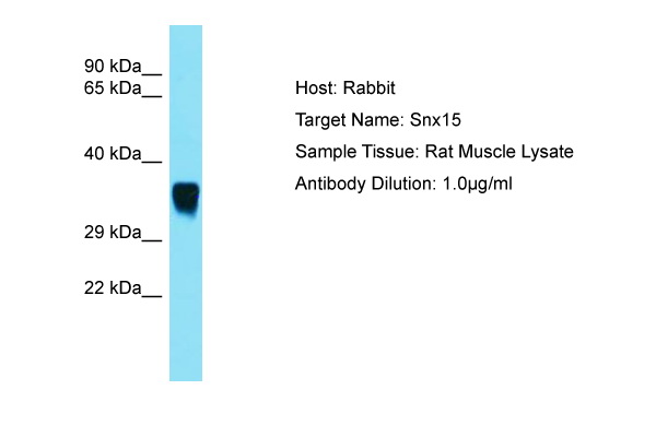 SNX15 Antibody -  This image was taken for the unconjugated form of this product. Other forms have not been tested.