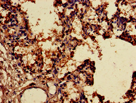 SNX15 Antibody - Immunohistochemistry of paraffin-embedded human lung tissue using SNX15 Antibody at dilution of 1:100