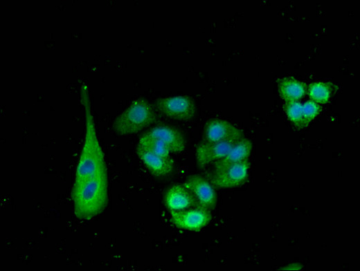 SNX15 Antibody - Immunofluorescent analysis of HepG2 cells using SNX15 Antibody at a dilution of 1:100 and Alexa Fluor 488-congugated AffiniPure Goat Anti-Rabbit IgG(H+L)