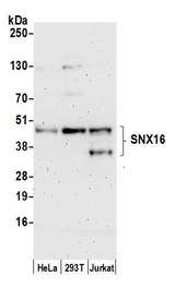 SNX16 Antibody - Detection of human SNX16 by western blot. Samples: Whole cell lysate (50 µg) from HeLa, HEK293T, and Jurkat cells prepared using NETN lysis buffer. Antibody: Affinity purified rabbit anti-SNX16 antibody used for WB at 1:1000. Detection: Chemiluminescence with an exposure time of 3 minutes.