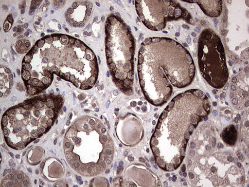 SNX16 Antibody - IHC of paraffin-embedded Human Kidney tissue using Rabbit polyclonal anti-SNX16 antibody at (Heat-induced epitope retrieval by 1 mM EDTA in 10mM Tris, pH8.5, 120°C for 3min).