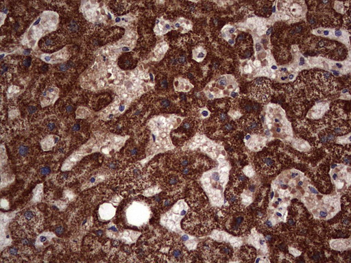 SNX16 Antibody - IHC of paraffin-embedded Human liver tissue using Rabbit polyclonal anti-SNX16 antibody at (Heat-induced epitope retrieval by 1 mM EDTA in 10mM Tris, pH8.5, 120°C for 3min).