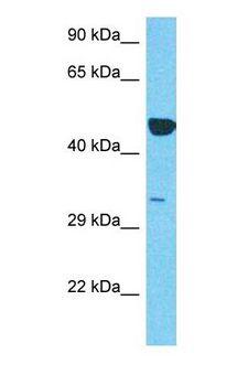 SNX16 Antibody - Western blot of SNX16 Antibody with human Thymus Tumor lysate.  This image was taken for the unconjugated form of this product. Other forms have not been tested.