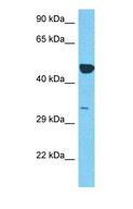 SNX16 Antibody - Western blot of SNX16 Antibody with human Thymus Tumor lysate.  This image was taken for the unconjugated form of this product. Other forms have not been tested.