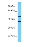 SNX17 Antibody - Western blot of SNX17 Antibody with human U937 Whole Cell lysate.  This image was taken for the unconjugated form of this product. Other forms have not been tested.
